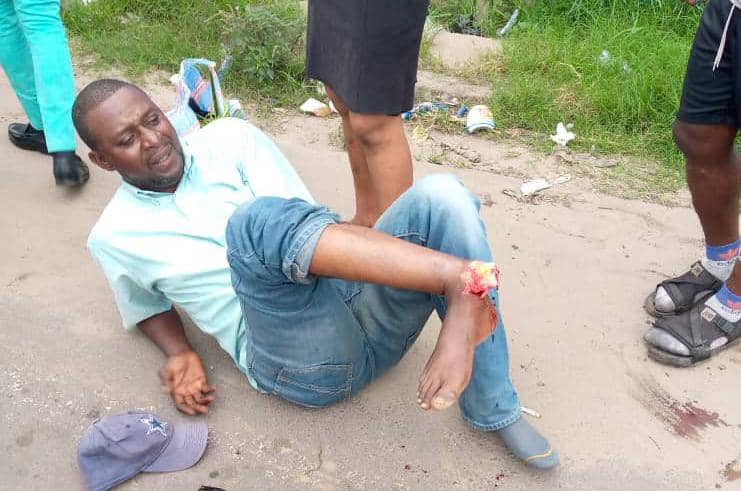 Un militant de l'Ecidé touché au pied par une balle réelle de la police nationale congolaise, vendredi 22 avril au siège du parti