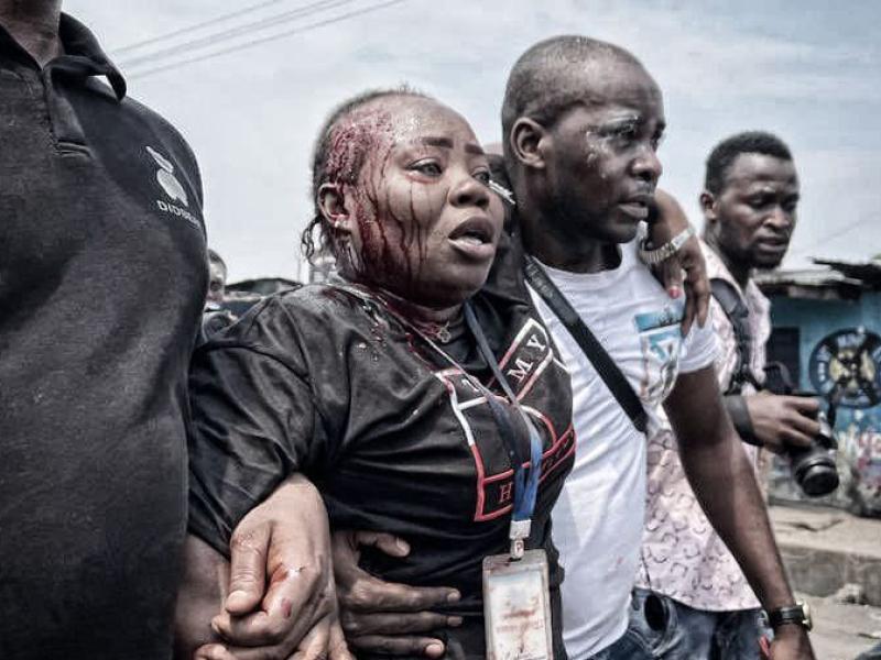La journaliste Gérone Djoko, victime d'une machette sur la tête lors de la récente marche de l'opposition secourue par ses confrères