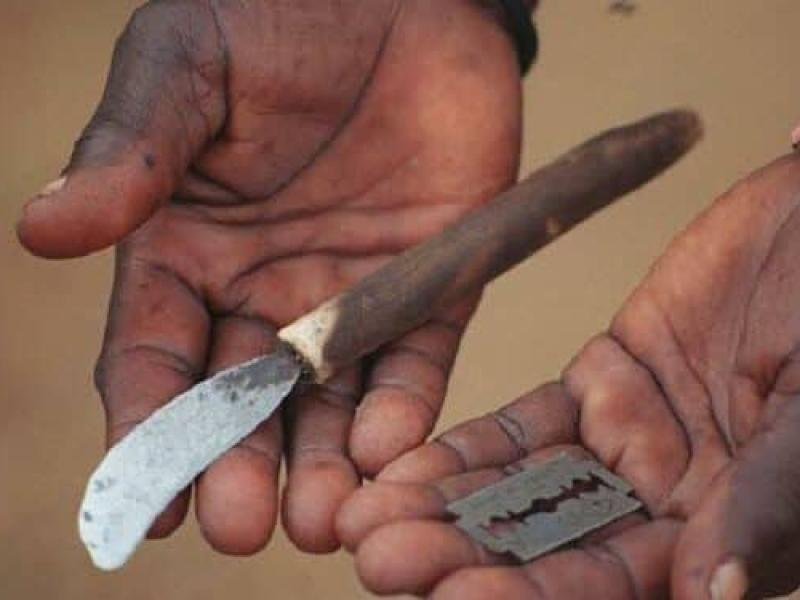 Quelques objets tranchants qui servent à la mutilation sexuelle [photo d'illustration]