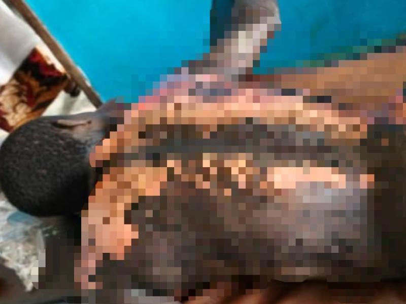 Un civil torturé par des miliciens Mobondo