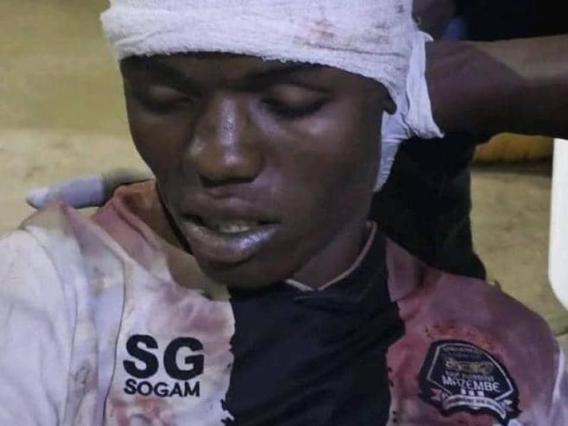 La victime du derby Lupopo-Mazembe.