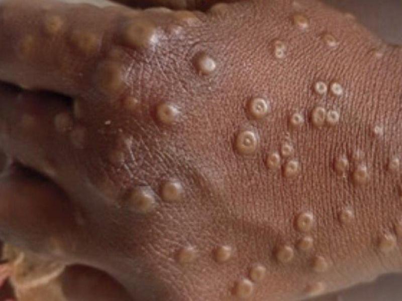 Photo d’illustration