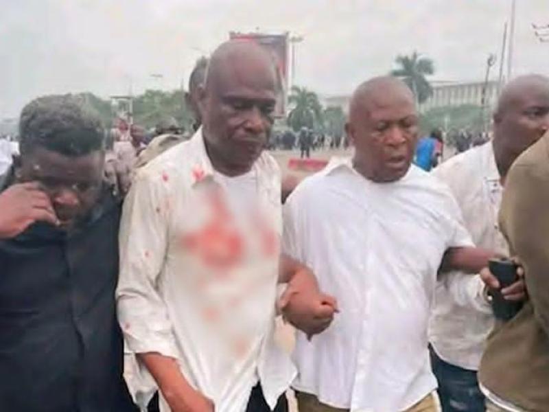 L’opposant Martin Fayulu, après son agression, lors de la dernière marche de la C64 aux abords du Palais du Peuple [photo d'illustration]