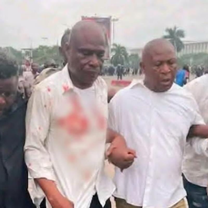 L’opposant Martin Fayulu, après son agression, lors de la dernière marche de la C64 aux abords du Palais du Peuple [photo d'illustration]