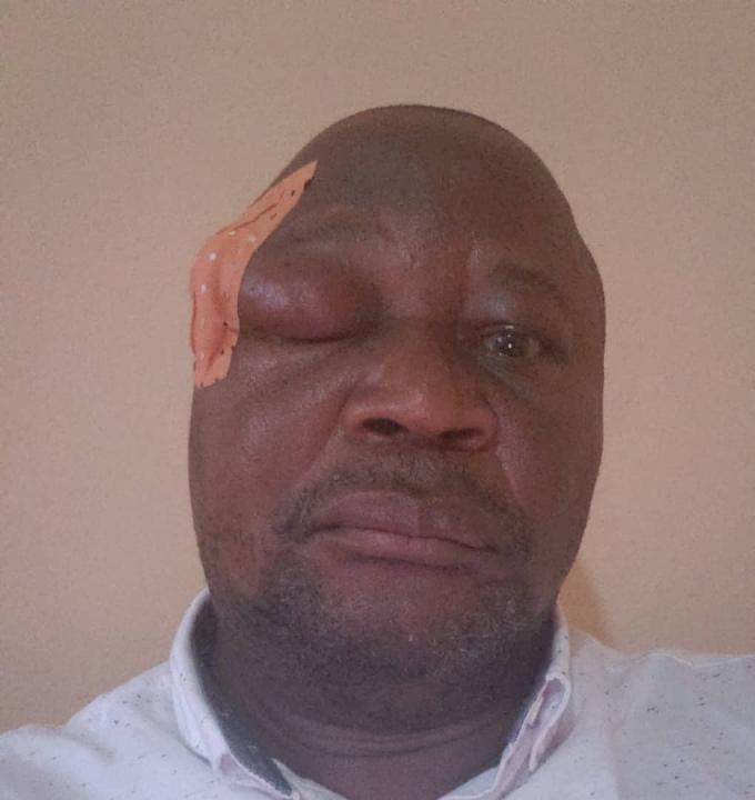 Paul N'sapu Mukulu, Vice-président de la Fédération Internationale des Droits de l'Homme (FIDH)