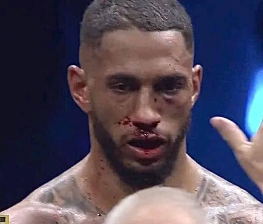 Tony Yoka défoncé par Martin Bakole à Paris Accor Arena.