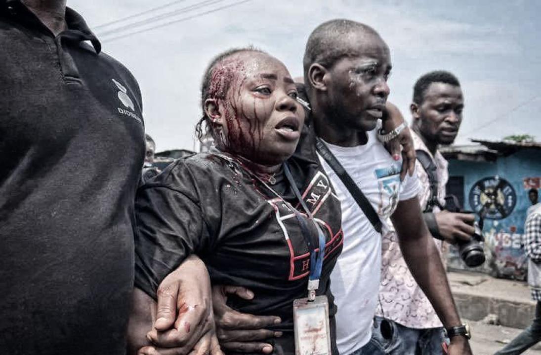 La journaliste Gérone Djoko, victime d'une machette sur la tête lors de la récente marche de l'opposition secourue par ses confrères