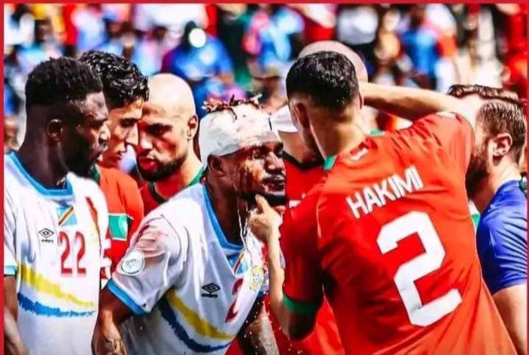 Le geste de charité de Achraf Hakimi envers le défenseur congolais Henock Inonga Baka. [Photo d'illustration]