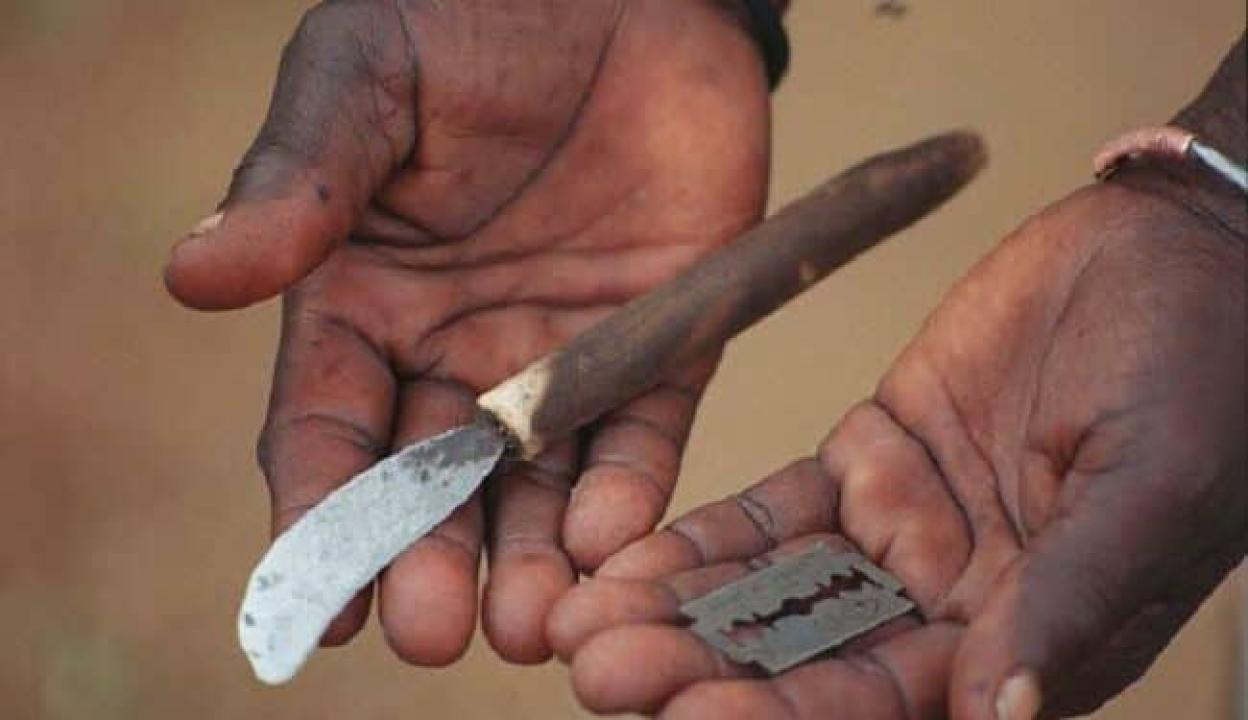 Quelques objets tranchants qui servent à la mutilation sexuelle [photo d'illustration]