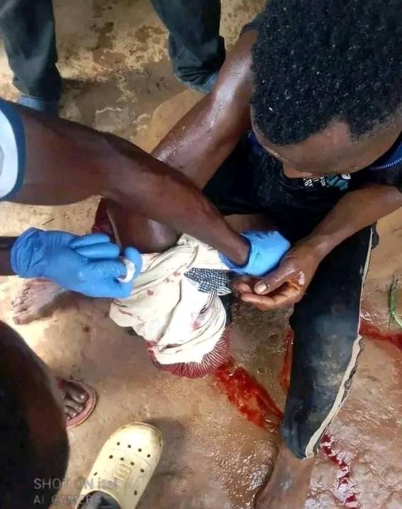 Un jeune victime d'une attaque d'un crocodile à Luozi dans le Kongo Central