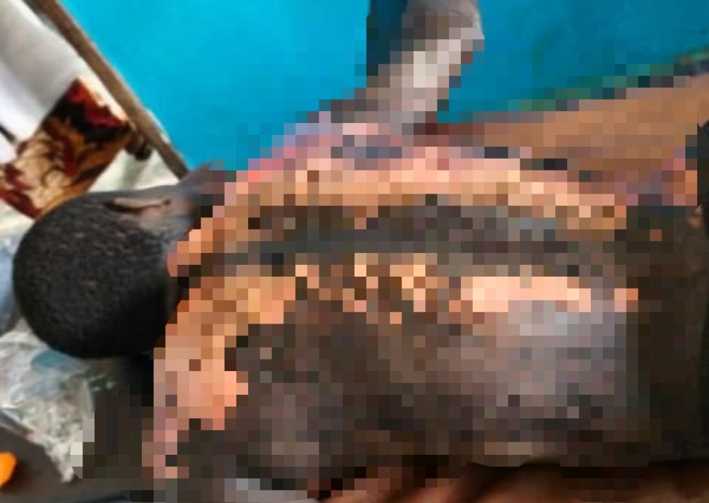 Un civil torturé par des miliciens Mobondo