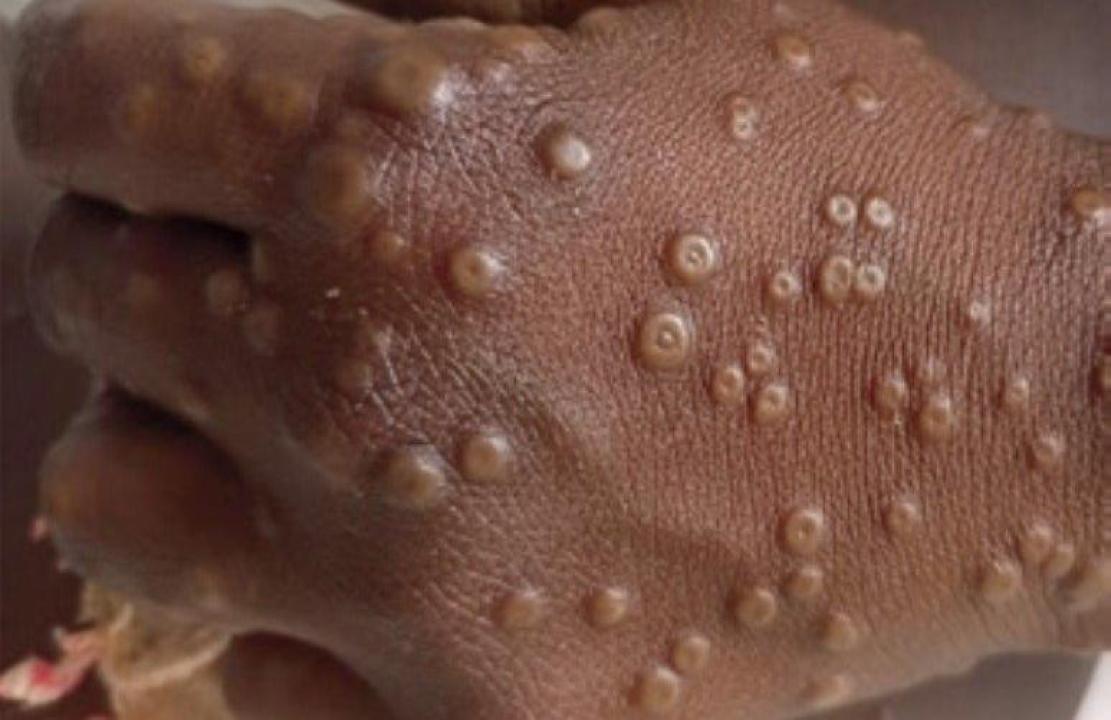 Photo d’illustration