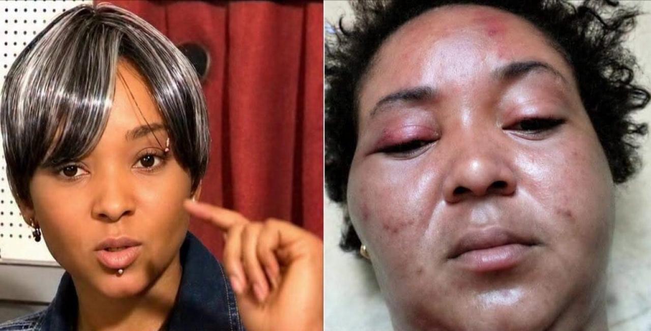Une femme victime, avant et après l’agression physique de son mari.