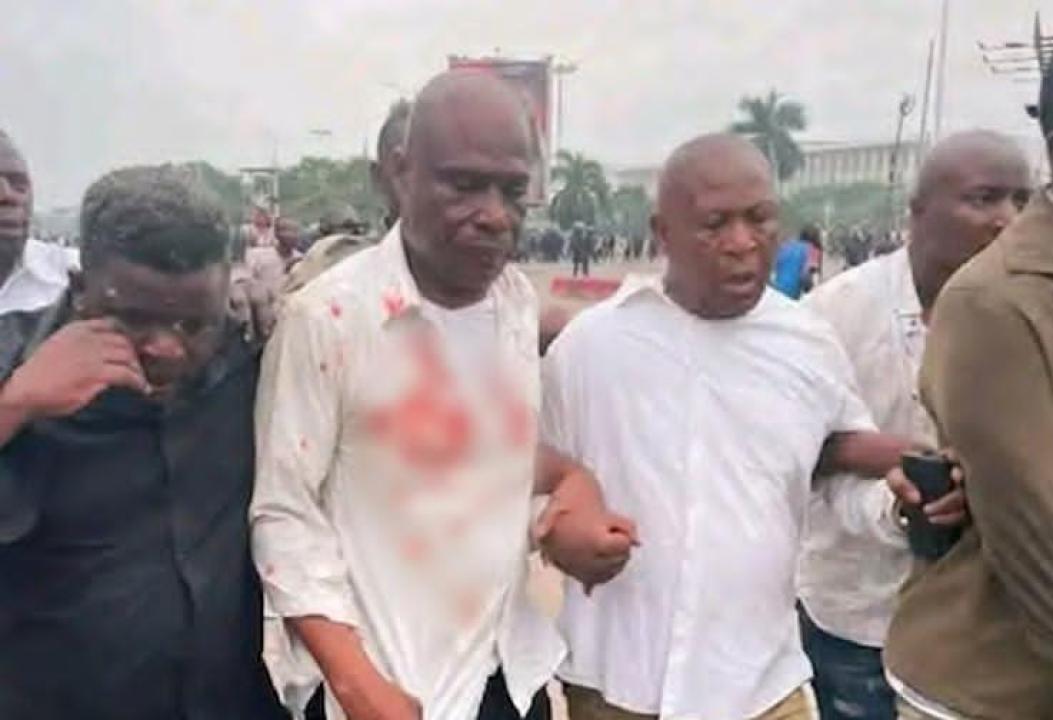 L’opposant Martin Fayulu, après son agression, lors de la dernière marche de la C64 aux abords du Palais du Peuple [photo d'illustration]